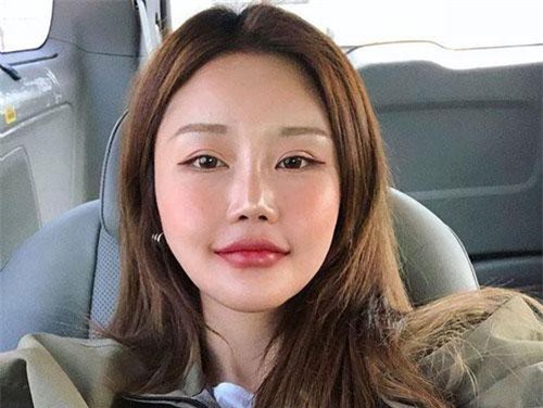 Gương mặt dao kéo gây tranh cãi của “bà trùm” thời trang mỹ phẩm Hàn Quốc