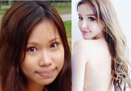 Hot girl số 1 của quốc đảo sư tử lộ ảnh trước khi phẫu thuật thẩm mỹ