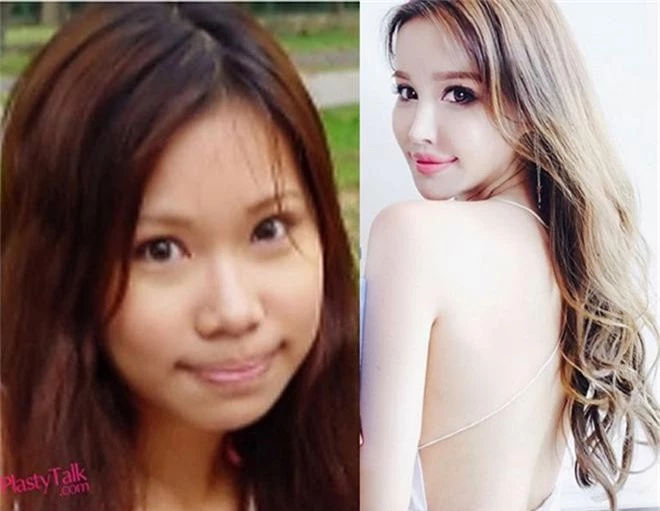 hot girl so 1 cua quoc dao su tu lo anh truoc khi phau thuat tham my hinh anh 2