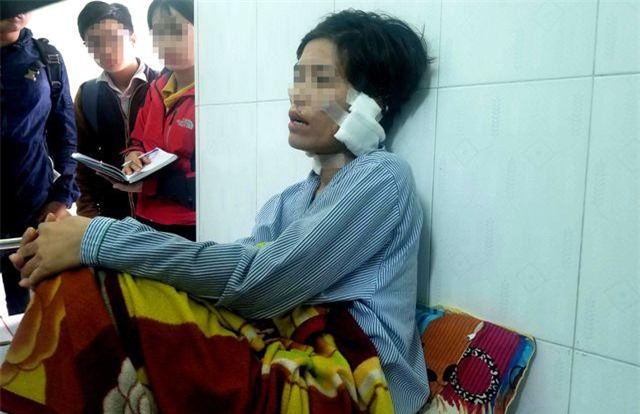 Quảng Nam: Cắt tai, bạo hành vợ cũ, chồng lãnh 42 tháng tù giam