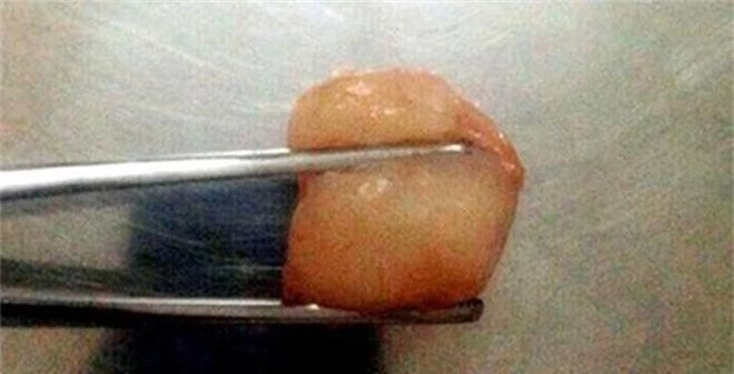 Những lưu ý an toàn khi cho trẻ ăn vải cha mẹ nào cũng cần nhớ - Ảnh 1. Những lưu ý an toàn khi cho trẻ ăn vải cha mẹ nào cũng cần nhớ - Ảnh 1.