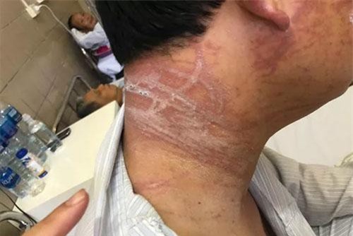 Cảnh giác nguy cơ va phải sứa khi tắm biển