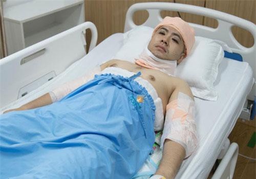 Tăng cân mất kiểm soát, Akira Phan can thiệp "dao kéo" để cải thiện ngoại hình?