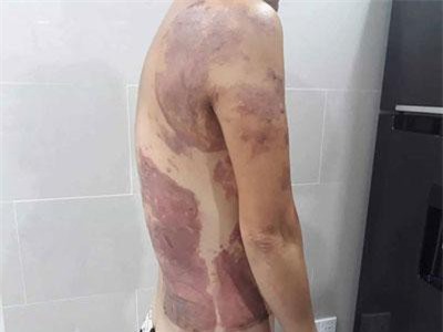 TPHCM: Nhắc nhở đậu xe bị hắt nguyên chảo dầu ăn vào người