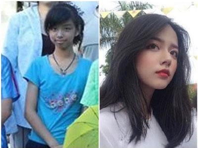 Nữ sinh Quảng Bình “dậy thì thành công” khiến dân mạng xuýt xoa