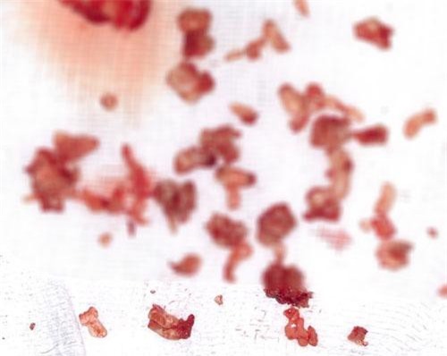 Khánh Hòa: Lấy gần 100 cái răng trong miệng thiếu niên 13 tuổi