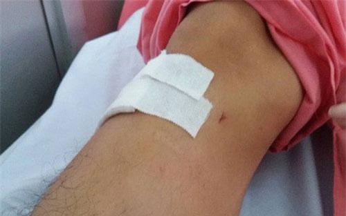 Khoan nhầm chân bệnh nhân ở bệnh viện Chợ Rẫy: Đình chỉ 2 nhân viên y tế