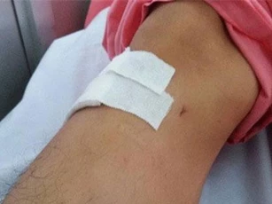 Khoan nhầm chân bệnh nhân ở bệnh viện Chợ Rẫy: Đình chỉ 2 nhân viên y tế