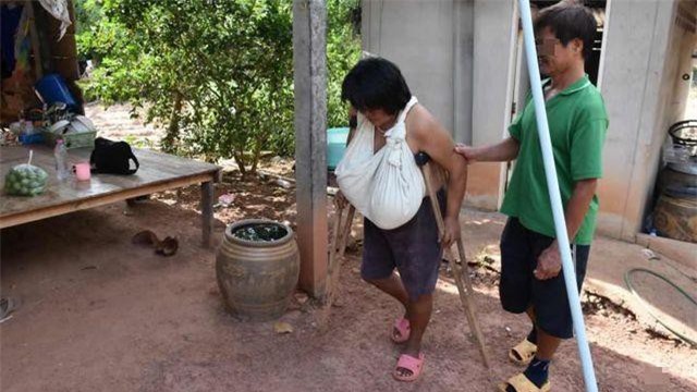 Bí ẩn người phụ nữ trung niên có bộ ngực phát triển không kiểm soát