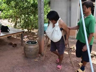 CLIP: Người phụ nữ kêu cứu vì bộ ngực phát triển không kiểm soát