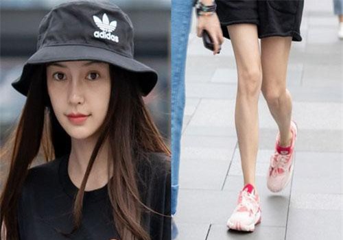 Tranh cãi với hình ảnh Angela Baby gầy đét, chân xương xẩu, nhan sắc bị ví như hotgirl mạng sửa mặt