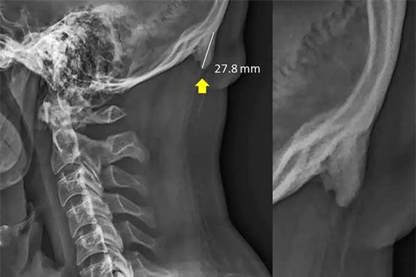 CLIP: Nghiên cứu mới gây sốc về tác hại của việc nghiện smartphone