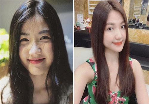 Lương Thanh "Những cô gái trong thành phố" dính nghi án dao kéo, ngày càng khác lạ với chiếc cằm nhọn bất thường