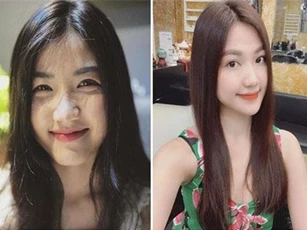 Lương Thanh "Những cô gái trong thành phố" dính nghi án dao kéo, ngày càng khác lạ với chiếc cằm nhọn bất thường