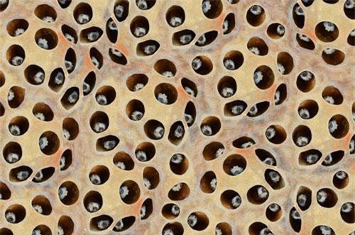 Giật mình những chứng bệnh đáng sợ gây ám ảnh cho con người