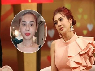 Lâm Khánh Chi lộ da mặt chùng nhão sần sùi sau 7 năm phẫu thuật chuyển giới