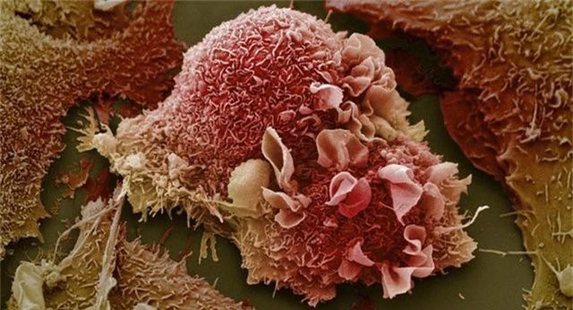 Khoa học phát hiện phương pháp điều trị ung thư mới - 1