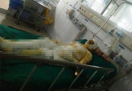 Nam Định: Con trai đổ xăng lên người 2 bố con tự thiêu