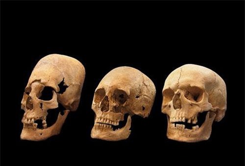 Vì sao phụ nữ Trung cổ có hộp sọ giống người ngoài hành tinh?