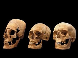 Vì sao phụ nữ Trung cổ có hộp sọ giống người ngoài hành tinh?