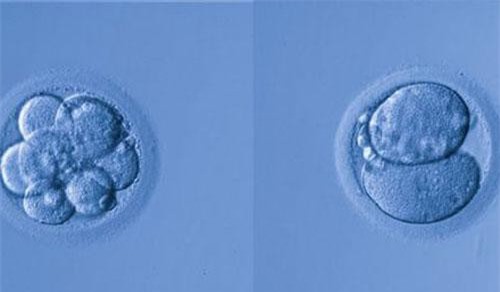 5 cặp vợ chồng người Nga đã đồng ý sử dụng chỉnh sửa gene để con không bị điếc?