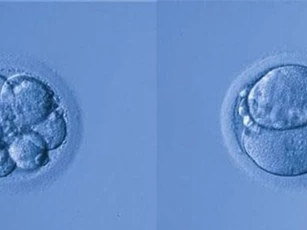 5 cặp vợ chồng người Nga đã đồng ý sử dụng chỉnh sửa gene để con không bị điếc?