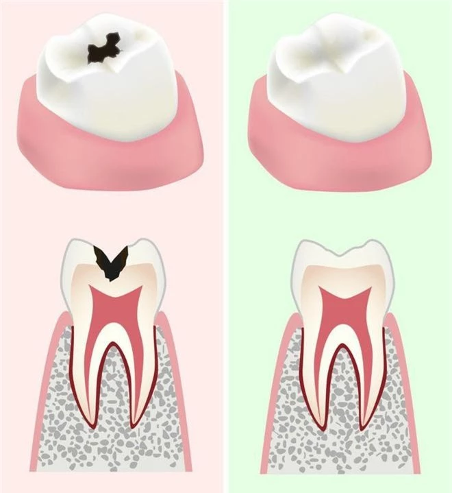 Ăn dưa chuột mỗi ngày giúp bạn thu về hàng loạt lợi ích đáng kinh ngạc, bao gồm cả giảm cân lẫn giảm nguy cơ ung thư - Ảnh 8.