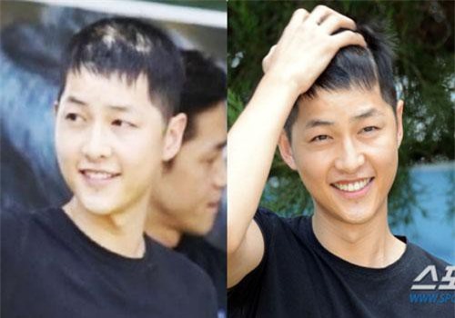 Tranh cãi ảnh Song Joong Ki bị hói đầu vì căng thẳng trong khi Song Hye Kyo tươi rói sau vụ ly hôn, sự thật là gì?