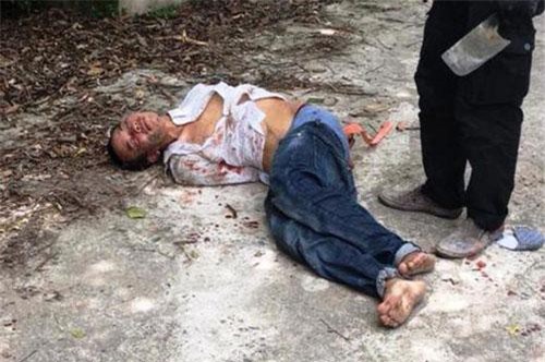 Nam Định: Chủ quán cầm đồ bị con nợ cứa cổ vì tranh cãi tiền lãi