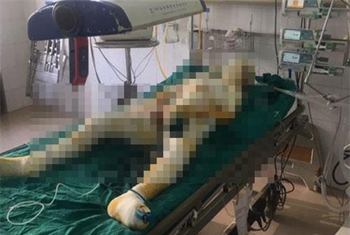 Nghi can phóng hỏa thiêu cả nhà người tình ở Sơn La đã tử vong