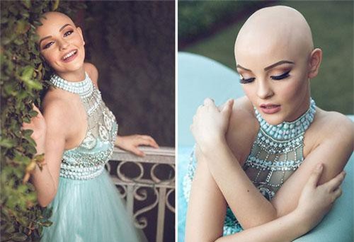 Cô gái 17 tuổi xinh như búp bê cắt trụi tóc để chụp ảnh, biết được sự thật ai cũng nể phục