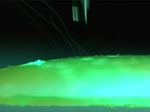 CLIP: Elon Musk cho ra mắt thiết bị đọc được suy nghĩ con người