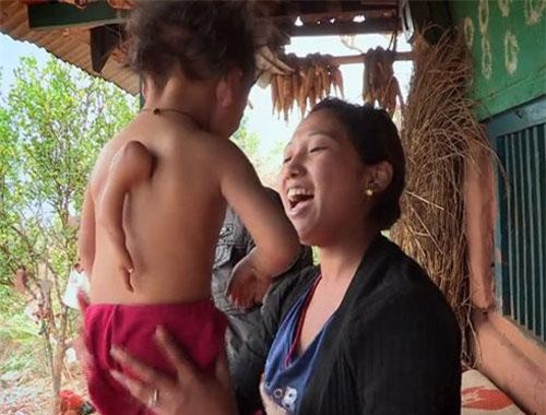 Bé trai có thêm cánh tay thứ 3 sau lưng