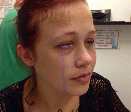 Sự thực hãi hùng về cô gái khóc ra nước mắt màu tím