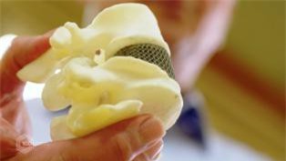 Trung tâm Chế tác công nghệ cao Đại học RMIT in thành công đĩa đệm cột sống 3D