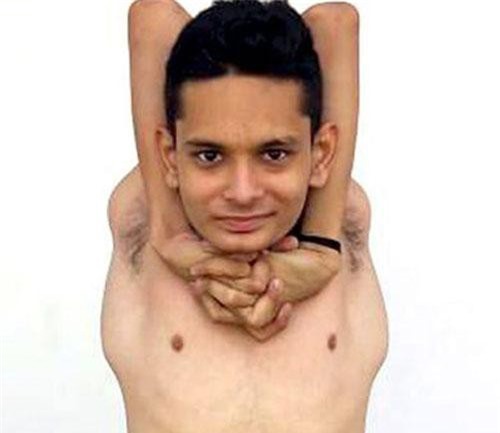 Kinh ngạc "cậu bé cao su" xoay khớp 360 độ