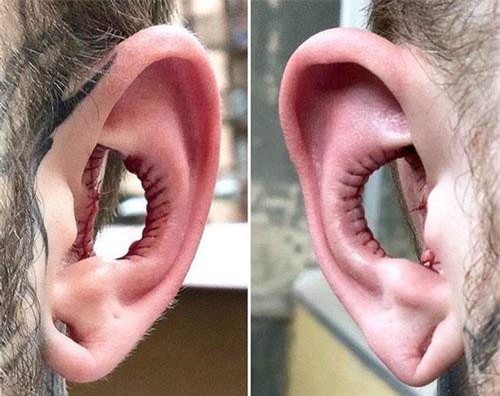Rùng mình "dị nhân" khoét bỏ vành tai chỉ vì ham muốn...