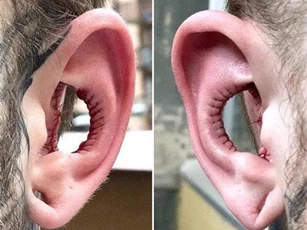 Rùng mình "dị nhân" khoét bỏ vành tai chỉ vì ham muốn...