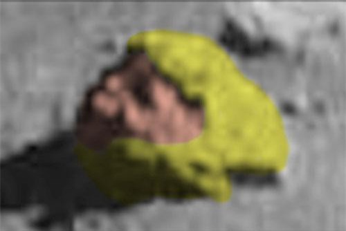 Bí ẩn hình ảnh gương mặt lạ lùng trên Mặt trăng