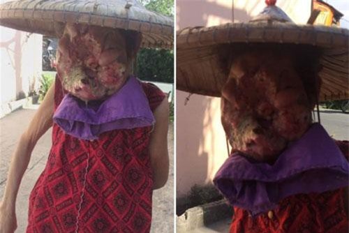 Xót xa người phụ nữ có "mặt quỷ", bị buộc ngủ với chó