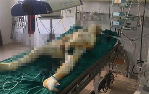 Vụ phóng hỏa cả nhà người tình: Nạn nhân thứ 4 tử vong