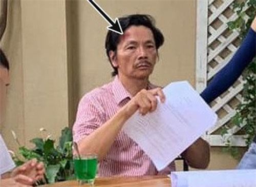 "Về Nhà Đi Con" lộ ảnh hậu trường bố Sơn bị thương chảy máu đầu?