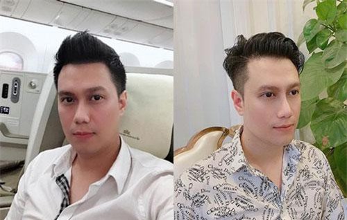 Đăng cận cảnh gương mặt đã hoàn thiện qua chỉnh sửa của Việt Anh, Quế Vân tiết lộ những bí mật gây 'sốc' phía sau cuộc phẫu thuật thẩm mỹ này