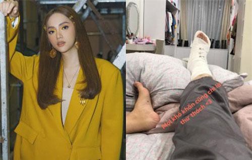 Fan lo lắng khi Hương Giang bất ngờ đăng ảnh chân băng kín vì chấn thương