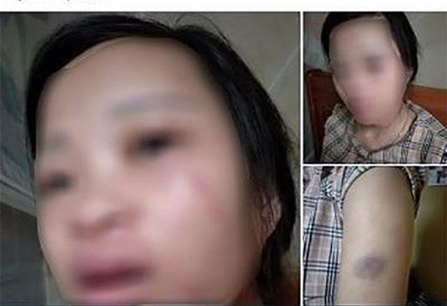 Nghệ An: Công an làm việc với người chồng đánh vợ đang mang thai vì "tội" mua hàng qua mạng