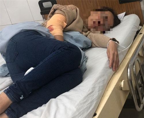 Lâm Đồng: Điều tra nhóm côn đồ bịt mặt chém trọng thương chủ quán cà phê