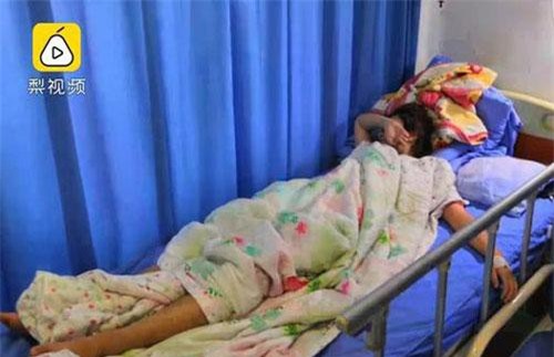 Thử thách squat 1.000 lần, cô gái và bạn rủ nhau nhập viện vì tổn thương thận