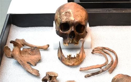 Hình ảnh bộ hài cốt được cho là xương của ma cà rồng cách đây 200 năm được khai quật.