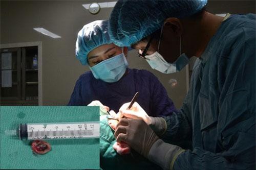 Nốt ruồi có biểu hiện ngứa, đi khám phát hiện ung thư da