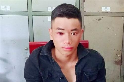 Nghệ An: Thiếu úy công an bị “con nghiện” dùng kim tiêm đâm khi vây bắt